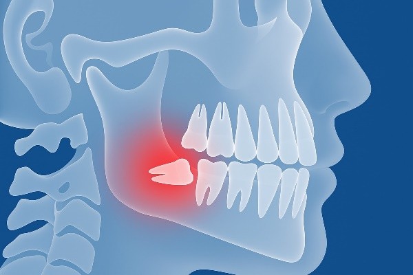 Imagen1 coralid dental